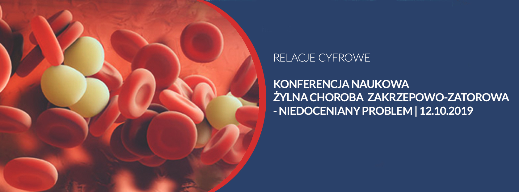Konferencja Naukowa Żylna Choroba Zakrzepowo-Zatorowa - niedoceniany problem | 12.10.2019
