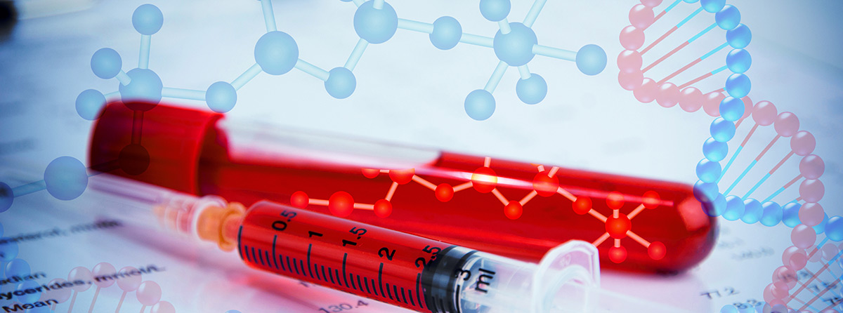 Nabyta zakrzepowa plamica małopłytkowa - stan naglący w hematologii
