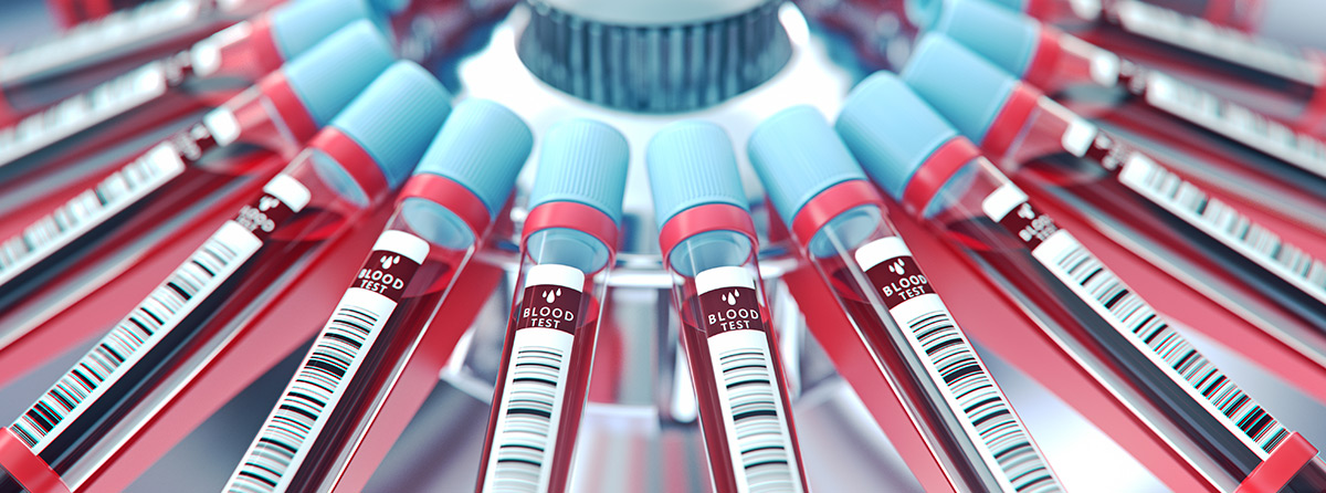 Hemostaza w praktyce: aktualny stan wiedzy