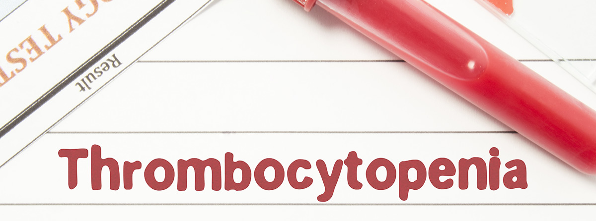 Leczenie drugiej linii chorych na pierwotną małopłytkowość immunologiczną