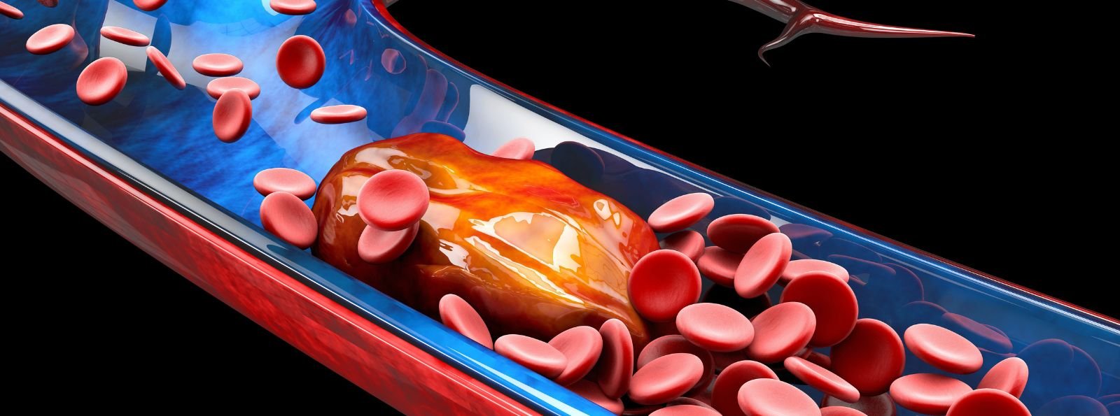 Farmakologiczna profilaktyka przeciwzakrzepowa u chorych hospitalizowanych z przyczyn internistycznych. Przegląd systematyczny i metaanaliza