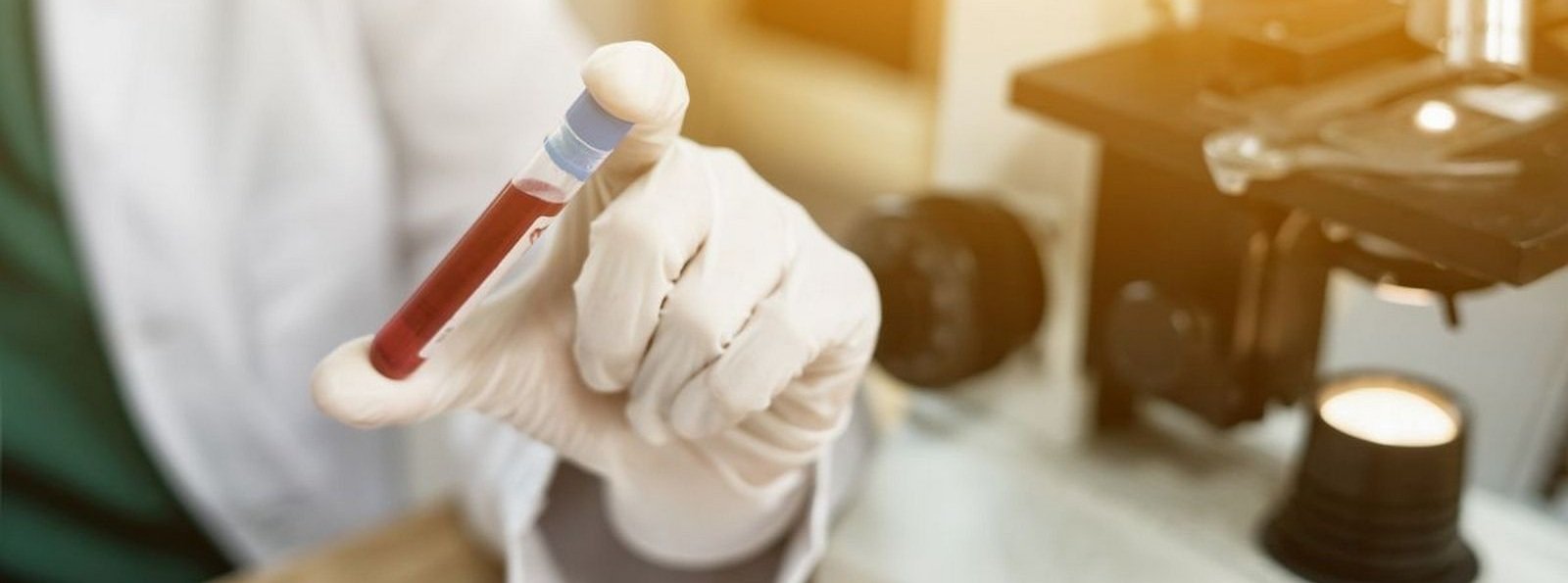 Nabyta hemofilia A – choroba, która nie wybacza opóźnień diagnostycznych