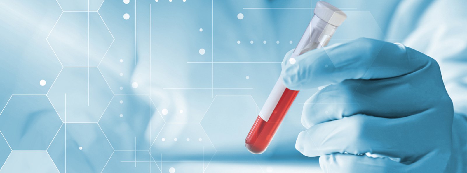 Badanie aktywności i inhibitora ADAMTS13 –  aktualności z międzynarodowego kongresu ISTH 2022
