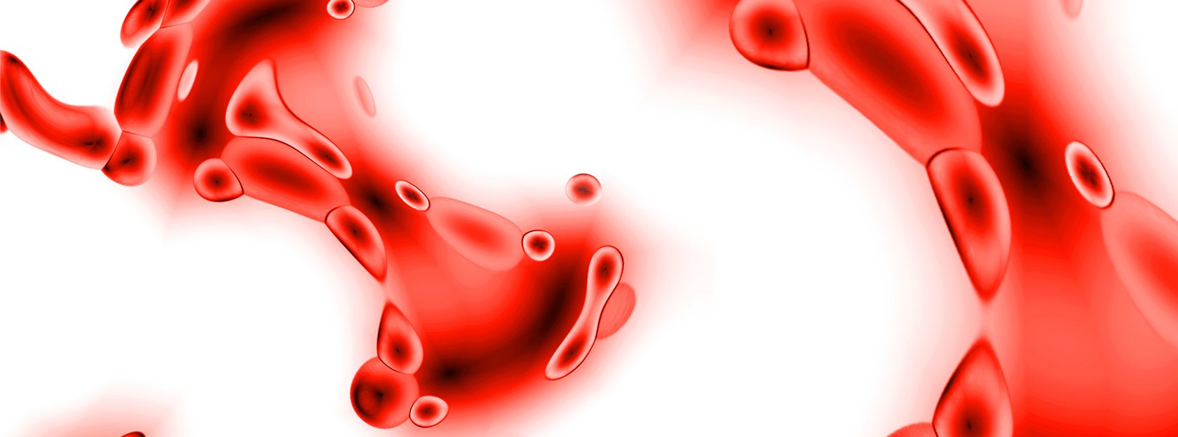 Leczenie dorosłych pacjentów z pierwotną małopłytkowością immunologiczną