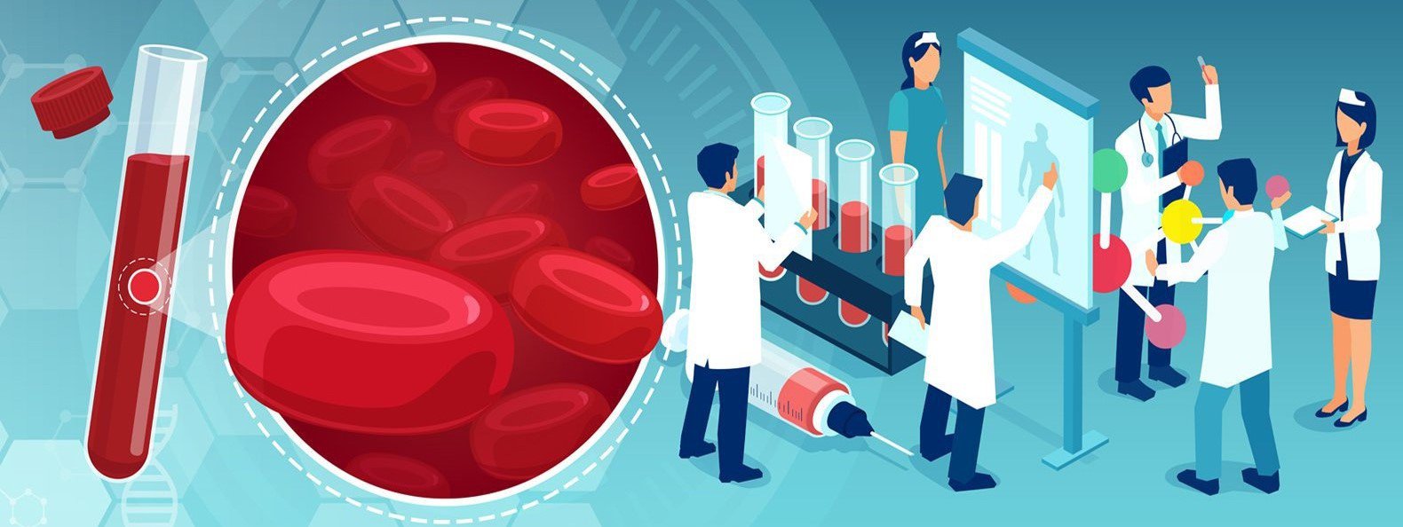 Immunologiczna zakrzepowa małopłytkowość poszczepienna – aktualny stan wiedzy