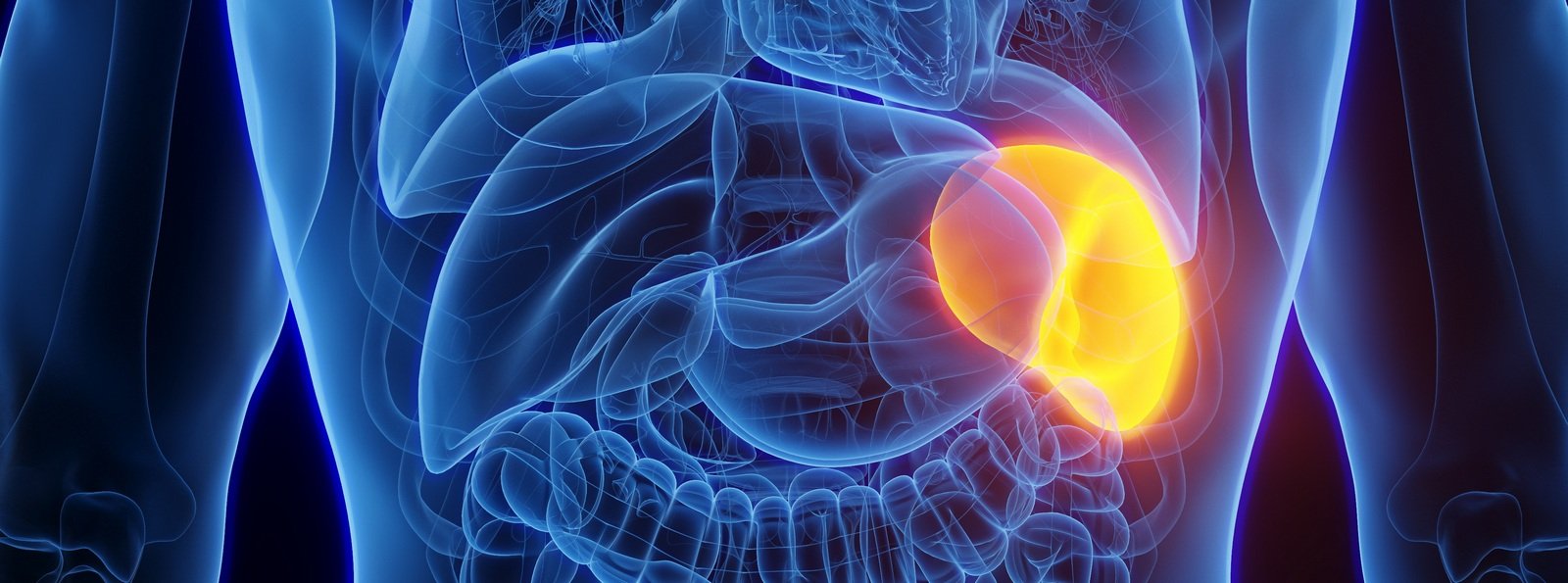 Splenektomia dorosłych chorych z małopłytkowością immunologiczną