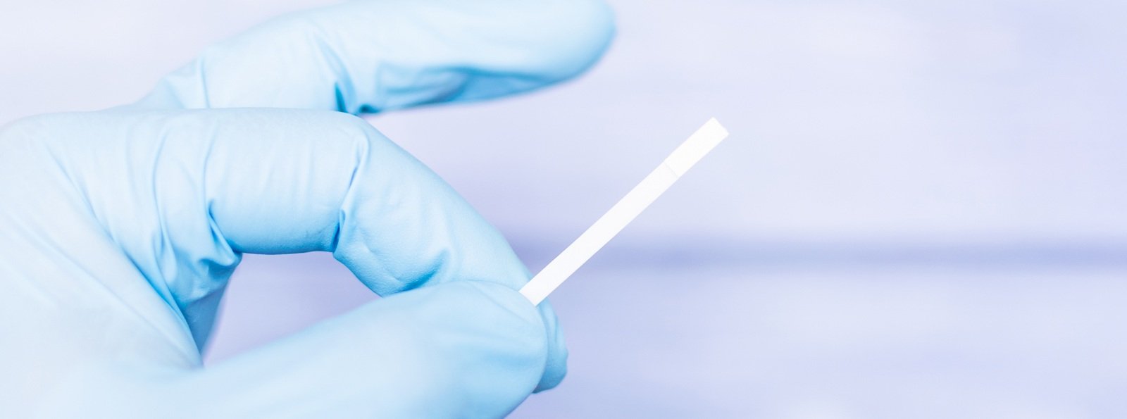 Zastosowanie testu paskowego do wykluczania klinicznie istotnych stężeń DOAC w osoczu – algorytm postępowania