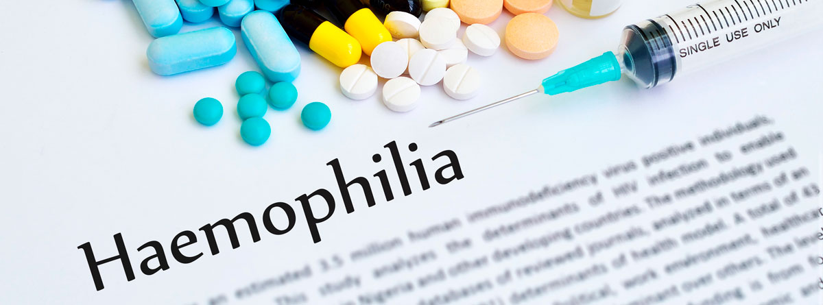 Część II: Wytyczne postępowania w hemofilii A i B powikłanej inhibitorem czynnika VIII i IX (2 wydanie)