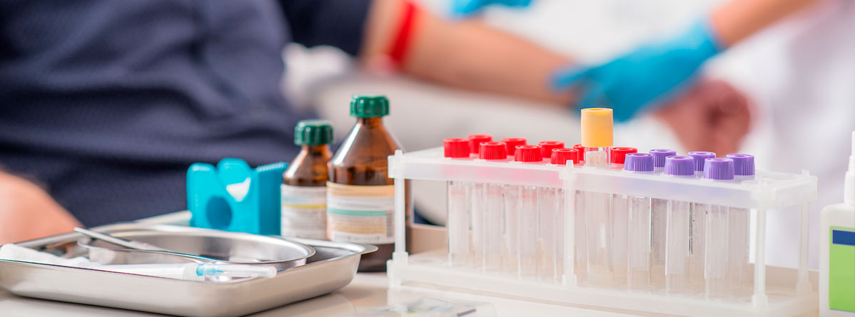 Postępowanie przedanalityczne w laboratoryjnej diagnostyce zaburzeń hemostazy